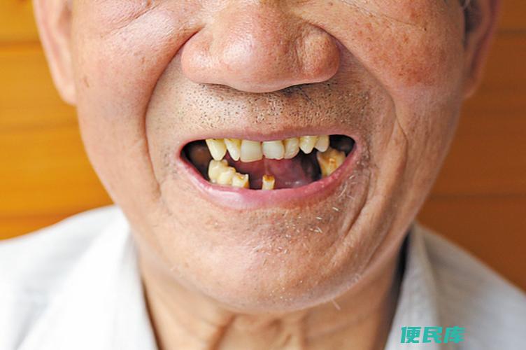 牙齿多少颗正常（不同年龄牙齿数量有哪些变化分析）
