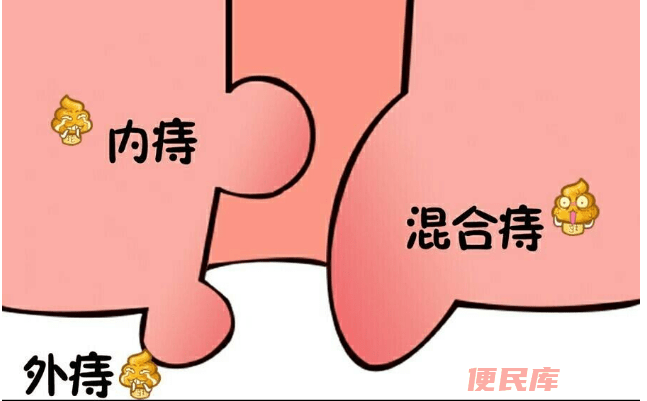 痔疮禁忌食物一览（列举不宜食用的痔疮禁忌食物）