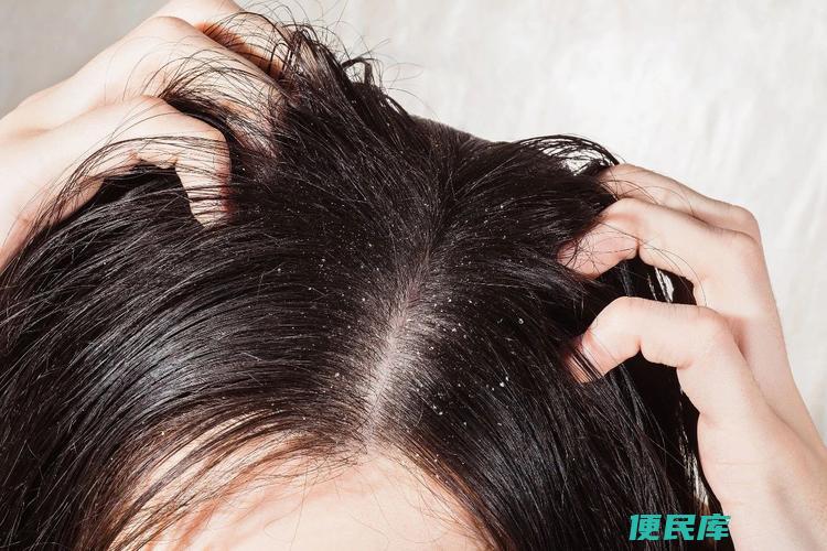 头皮屑是怎么生成的（解释头皮屑形成的原因）