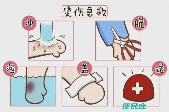 缓解烫伤的疼痛方法（应对烫伤疼痛的缓解技巧）