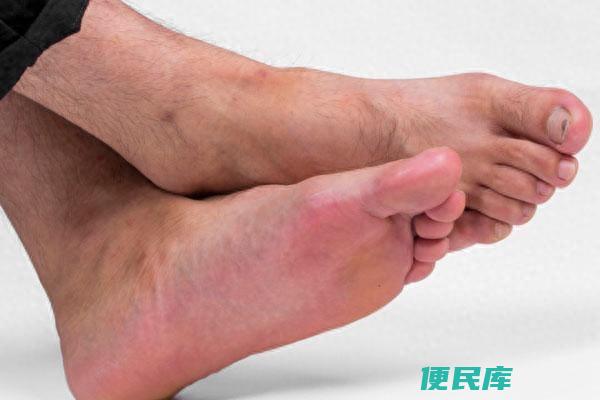 脚底发热是怎么回事（为什么一到晚上脚心就发热呢）