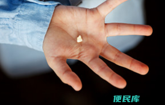 梦见别人掉牙齿的征兆（梦见他人失去牙齿的预示意义）