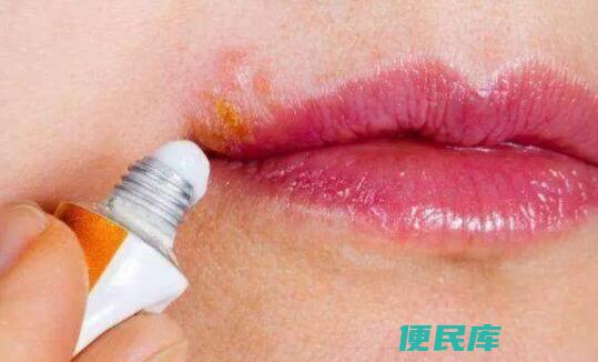 嘴巴上火了怎么办（缓解口腔溃疡的方法）