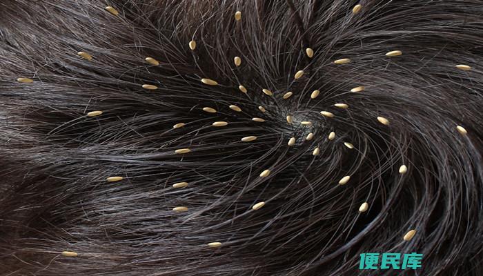 头上有虱子怎么办（处理头部虱子的技巧）