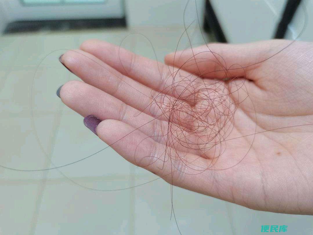 生姜怎么用能生发（常用生姜洗头发会发生哪些变化）