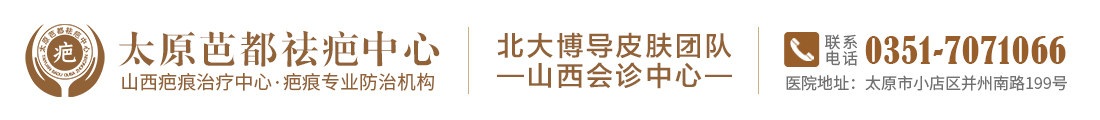太原疤痕医院，太原治疗疤痕疙瘩医院，太原激光治疗疤痕医院
