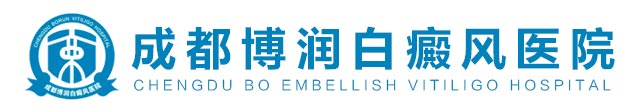 成都治疗白癜风去哪里