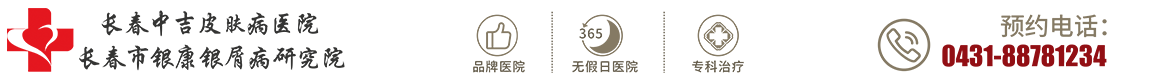 长春皮肤病医院