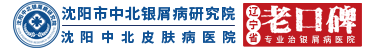 「沈阳银屑病医院」